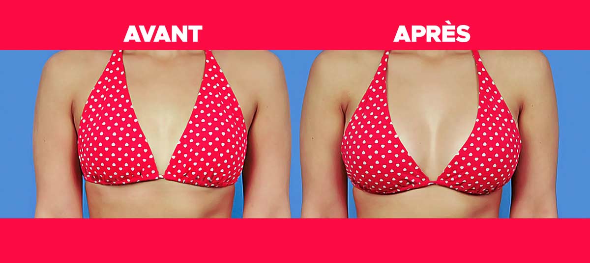 Comment Faire Grossir Ses Seins Naturellement - On Fait Comment