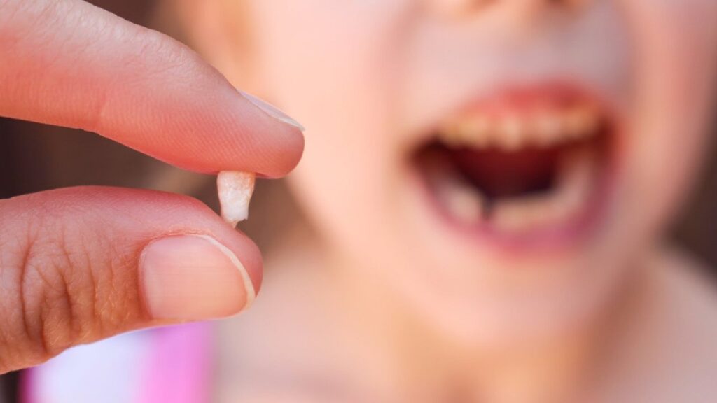 Comment faire tomber une dent - On Fait Comment