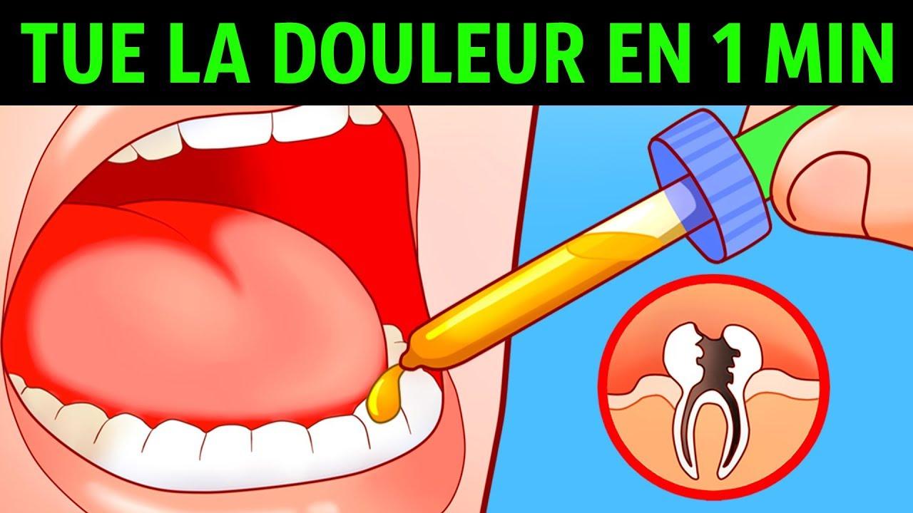 Comment faire passer mal de dent