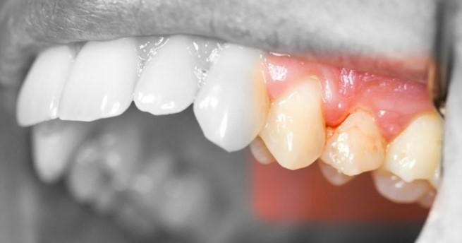 Prévenir le gonflement : conseils au quotidien