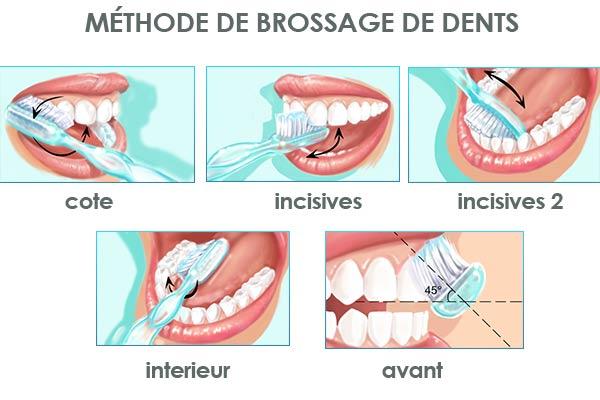 Les bonnes pratiques dhygiène bucco-dentaire