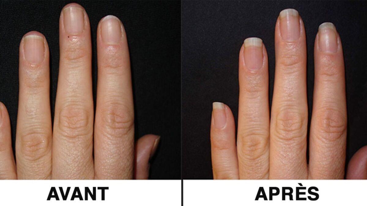 Comment faire pour pousser les ongles