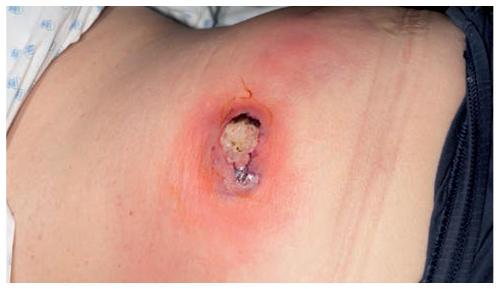 Comment faire mûrir un panari