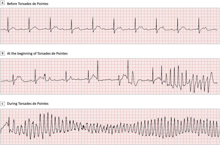 Astuces pour embellir vos projets tricot avec des torsades originales