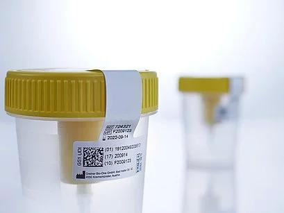 Comment faire un test urinaire