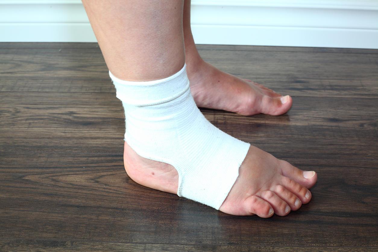 Comment faire dégonfler un œdème au pied