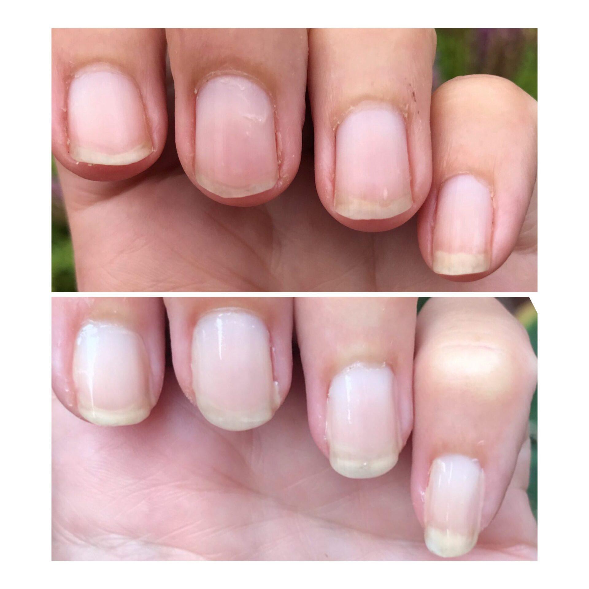 Comment faire pousser les ongles