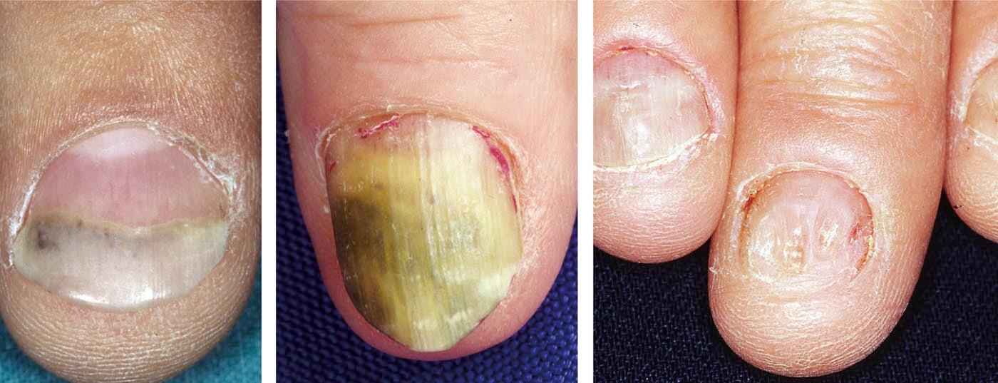 Conseils pratiques pour maintenir vos ongles en pleine santé après la nuit