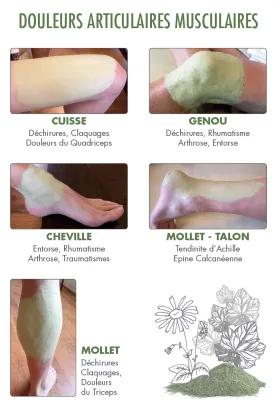 Préparer votre cataplasme : les étapes à suivre