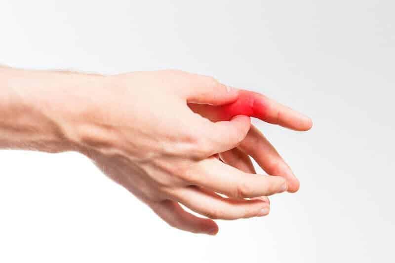 Quand consulter ​un professionnel ⁢de la santé pour vos douleurs‌ aux ⁣doigts