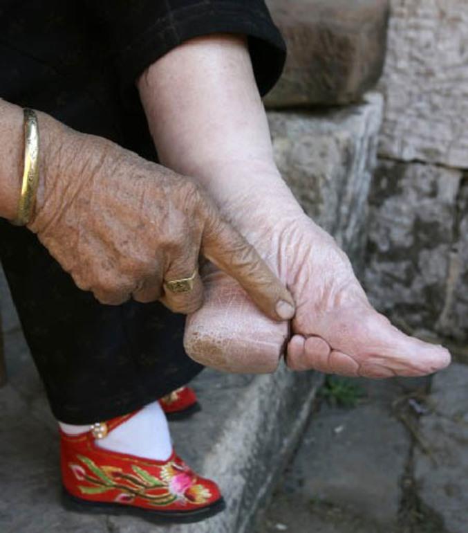 Comment faire pour dégonfler les pieds