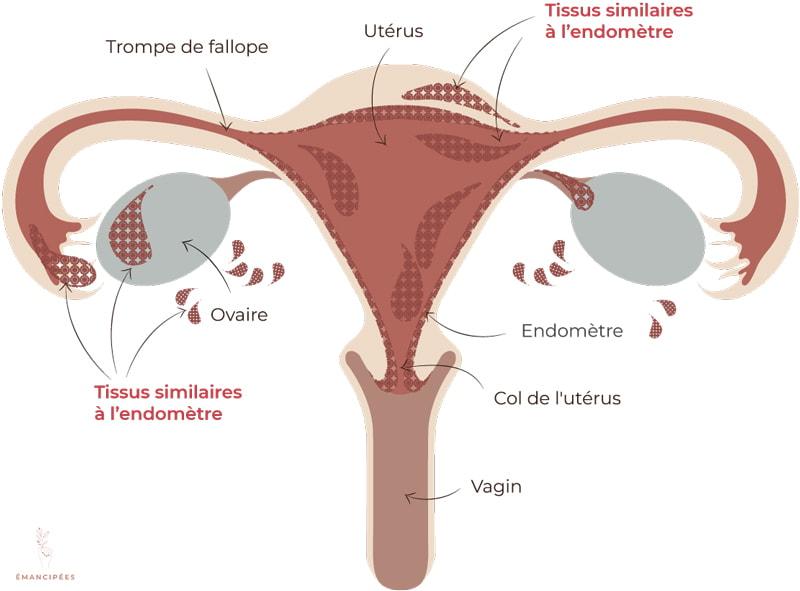 Comment faire passer la douleur des règles