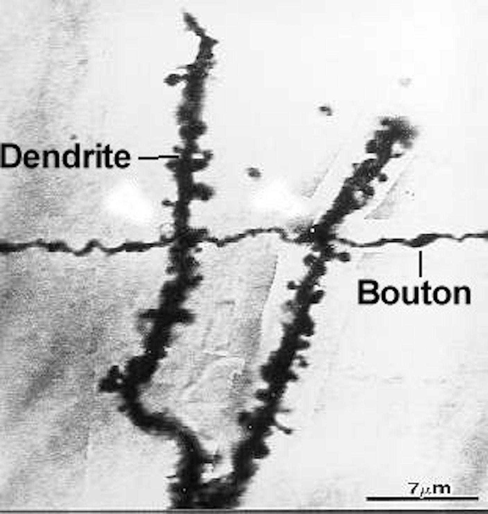 Comment faire disparaitre bouton