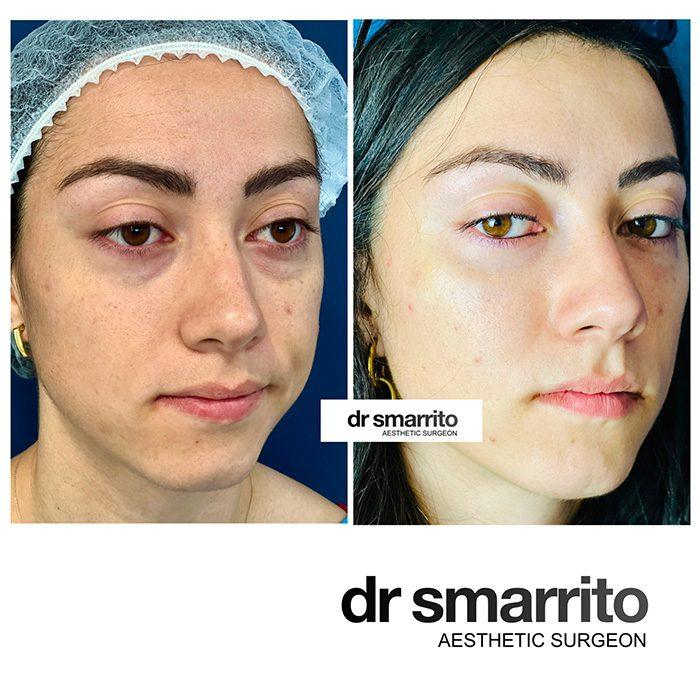 Les ‍secrets dun regard éclatant : comprendre ⁢les cernes