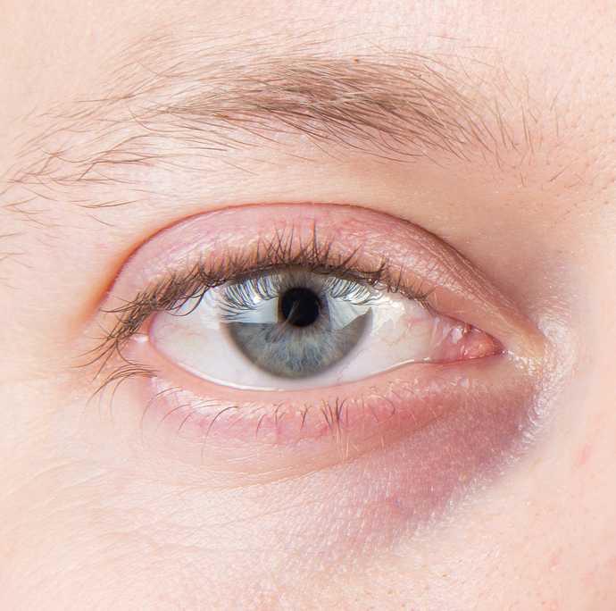 Comment faire partir des cernes